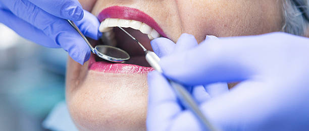Best Emergency Treatment for Dental Infections or Abscesses in Hoosick Falls, NY